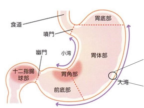 赴日医疗：胃癌的治疗不是奢求