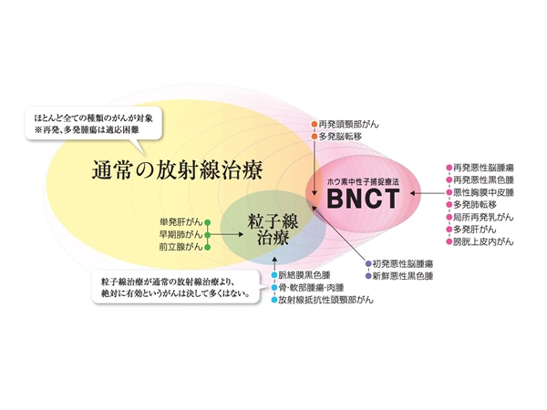 硼中子俘获疗法临床试验招募进行中