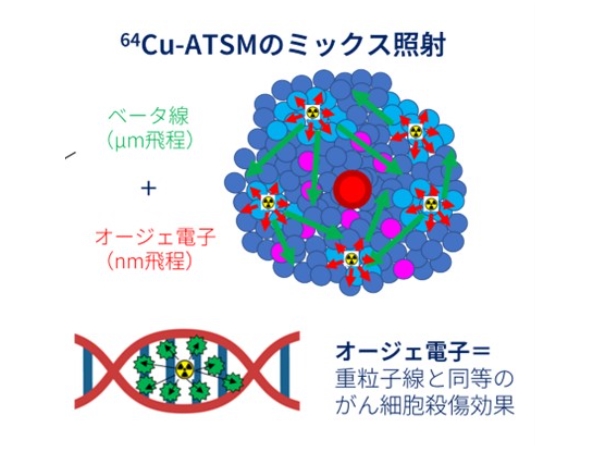 针对WHO 3-4级标准治疗后复发性恶性脑胶质瘤患者的64Cu-ATSM放射性治疗药物实验