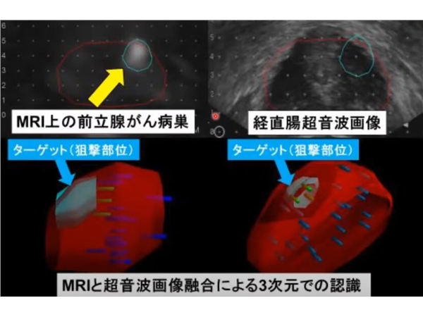 前列腺癌治疗的新时代：诊断革新、精准治疗与多学科协作的未来
