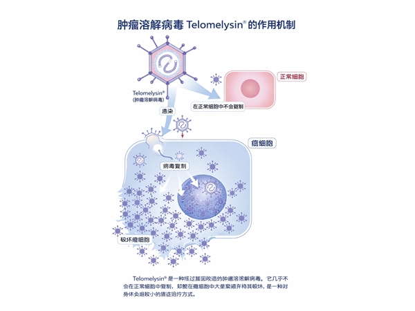 给无法手术的食管癌患者带来新希望