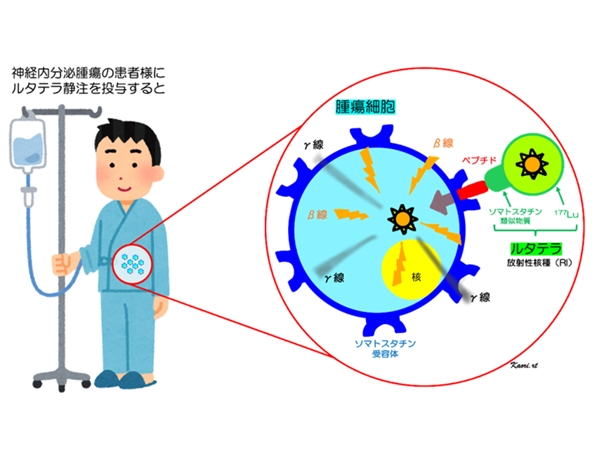 什么是鲁塔特拉疗法（PRRT疗法）？
